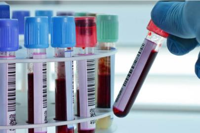 Başlangıçta genellikle sinsice ilerliyor