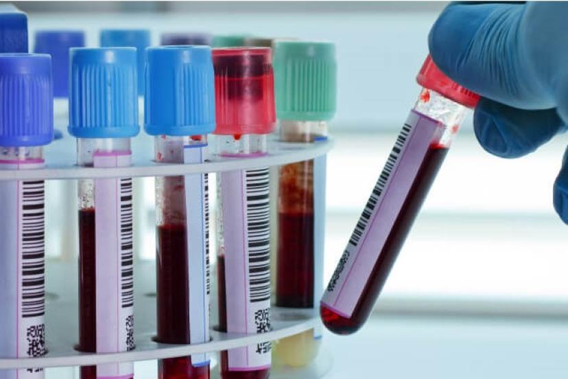 Başlangıçta genellikle sinsice ilerliyor