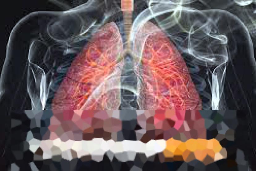 Yeşilay Uyardı: Türkiye’de Gençler Sigaraya Çocuk Yaşta Başlıyor