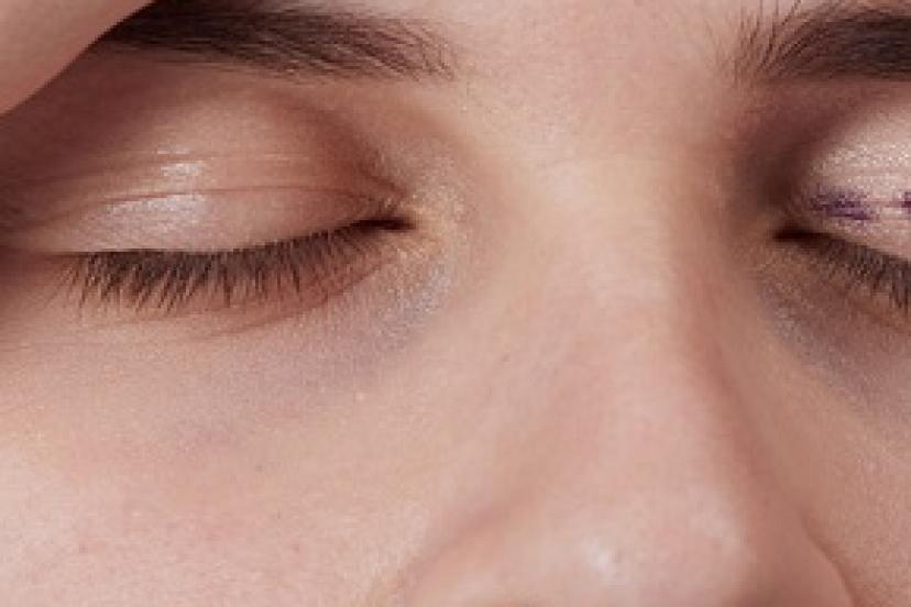 Göz kapağı ameliyatı hangi durumlarda gerekli?