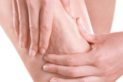 "Selülit" deyip geçmeyin!