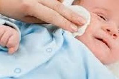 Bebeklerde göz sulanması sorunu nasıl çözülür?