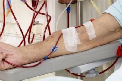 Diyaliz hastalarının dikkat etmesi gereken 6 nokta